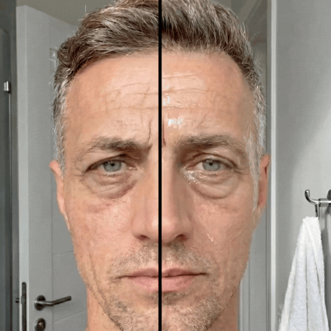 Applicazione FaceLife Serum effetto pelle distesa
